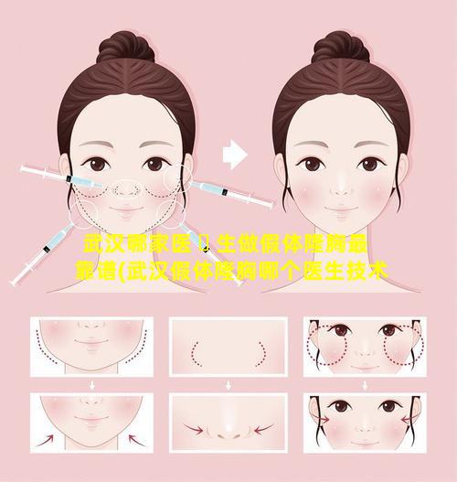 武汉哪家医 ☘ 生做假体隆胸最靠谱(武汉假体隆胸哪个医生技术好)